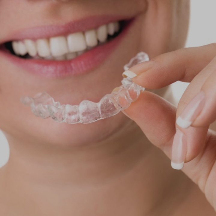 Skuteczne wybielanie zębów – metody